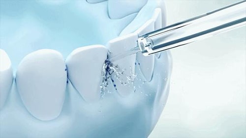 Mupangate Flosser banyu kanggo para pemaman sing bisa digunakake